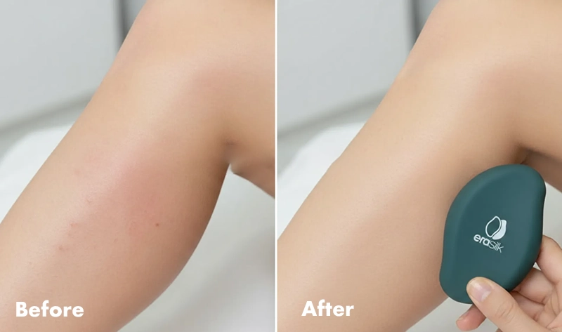 Crystal Hair Remover