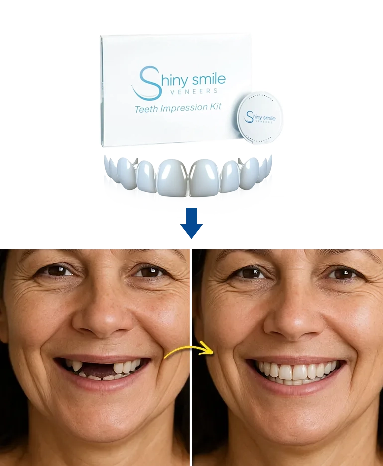 Shiny Smile Before and After